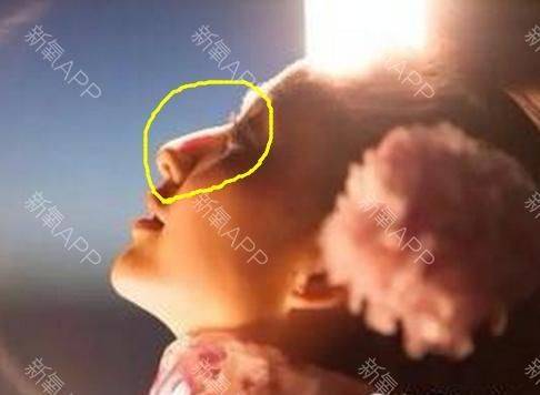 How much for a narrow nose