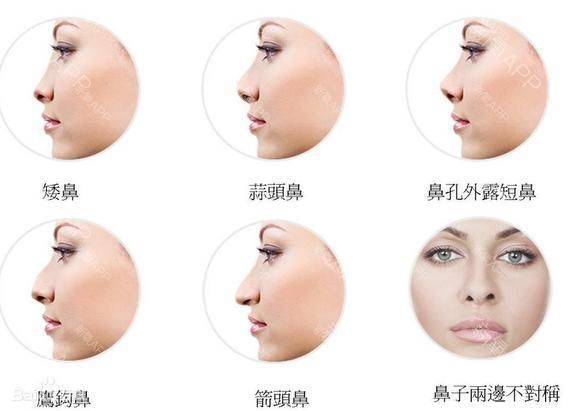 How much for a narrow nose