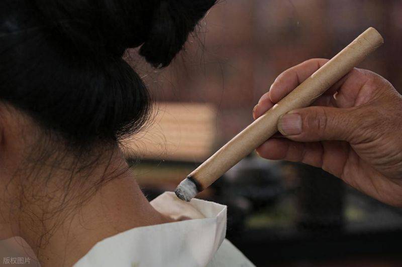 Acupuncture method