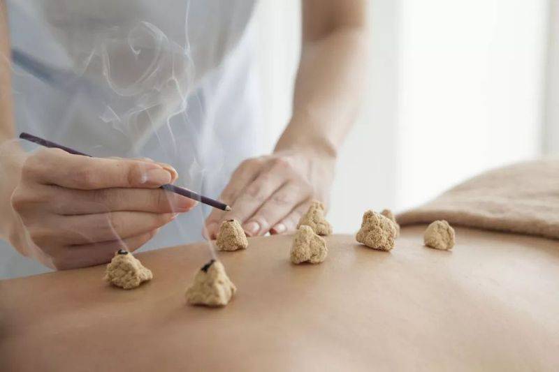 Acupuncture method