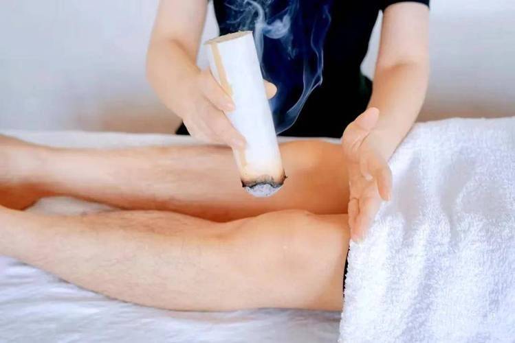 Acupuncture method