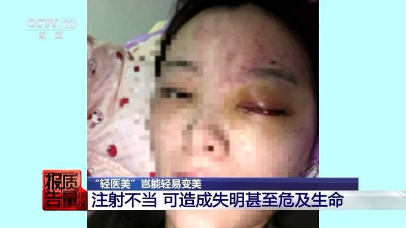 白晋博士丰胸多少钱