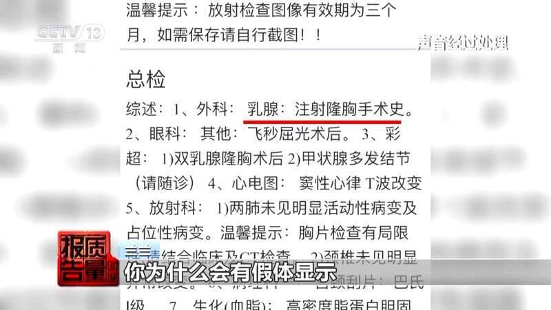 白晋博士丰胸多少钱