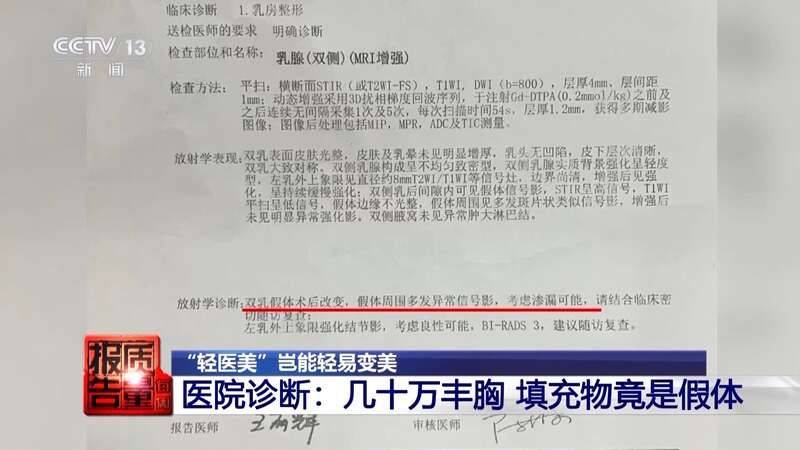 白晋博士丰胸多少钱