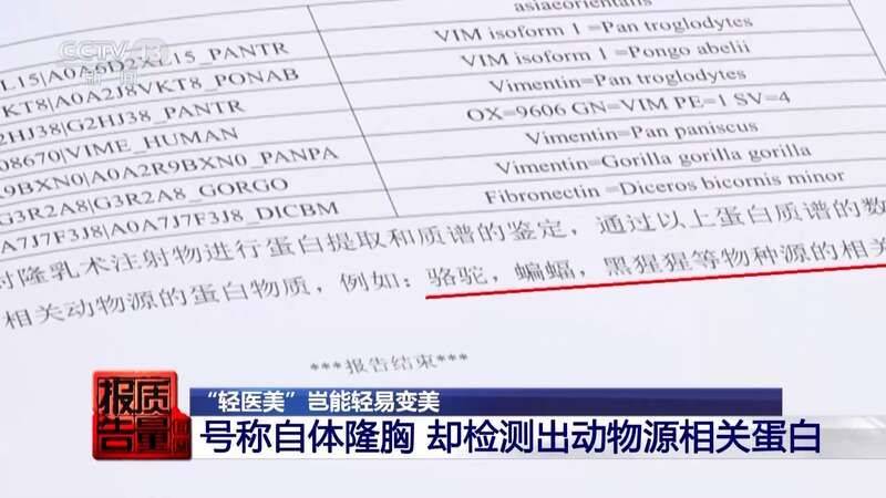 白晋博士丰胸多少钱