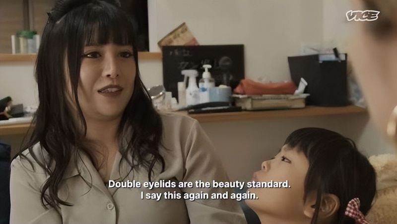 日本割双眼皮多少钱