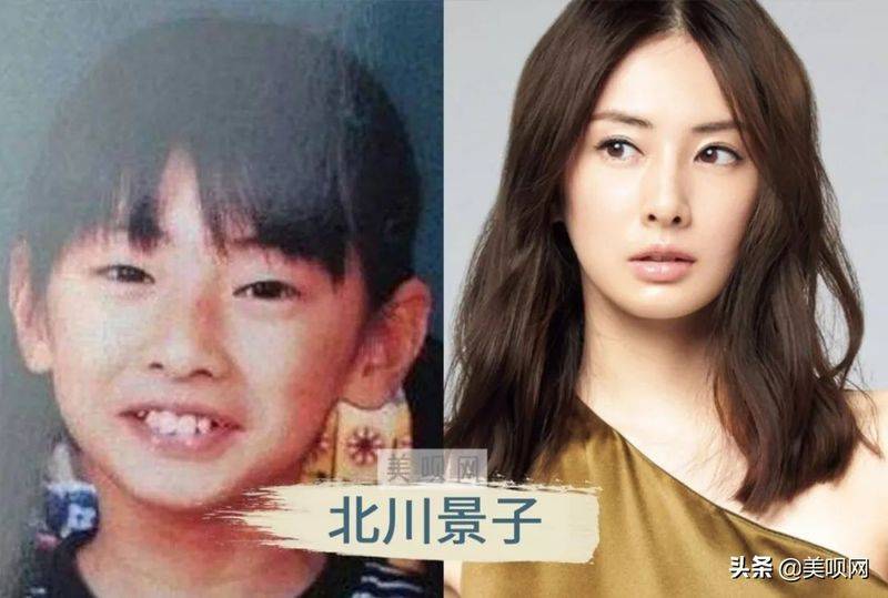 日本割双眼皮多少钱