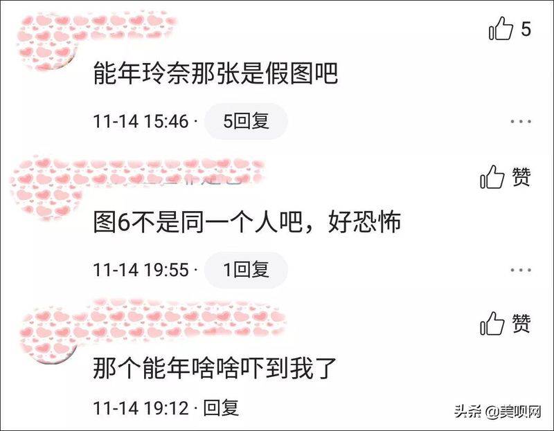 日本割双眼皮多少钱