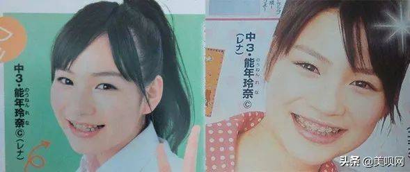 日本割双眼皮多少钱
