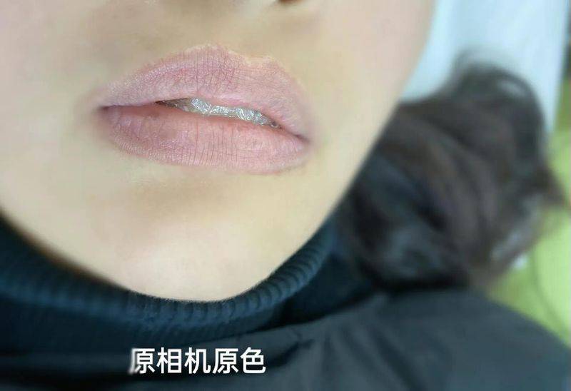 丰唇多少钱