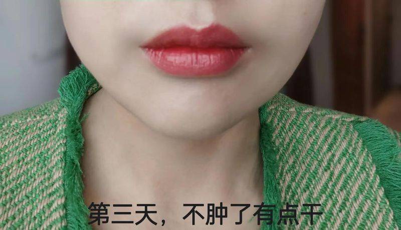 丰唇多少钱