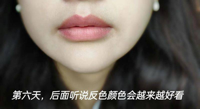 丰唇多少钱