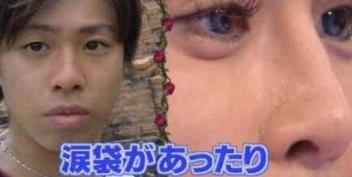 How much is japan's eyelid cut