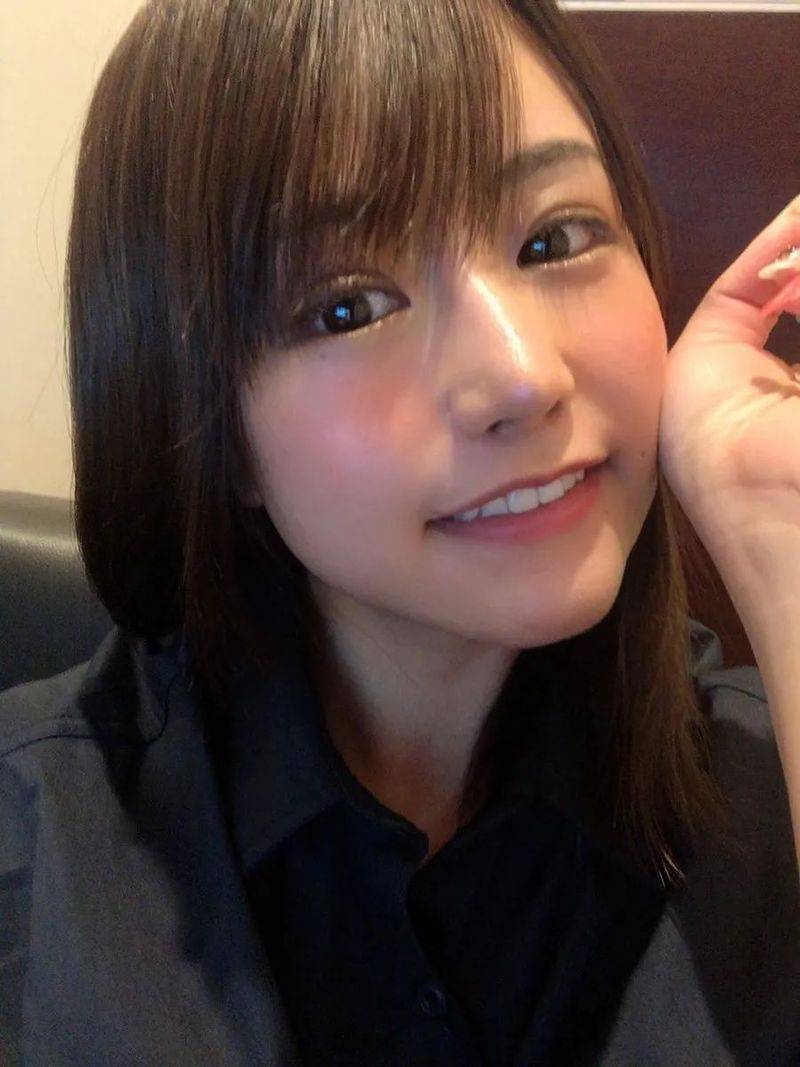 日本割双眼皮多少钱