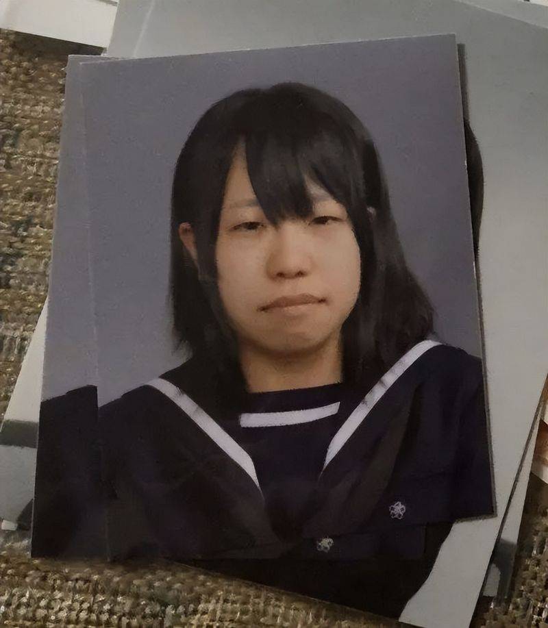 日本割双眼皮多少钱