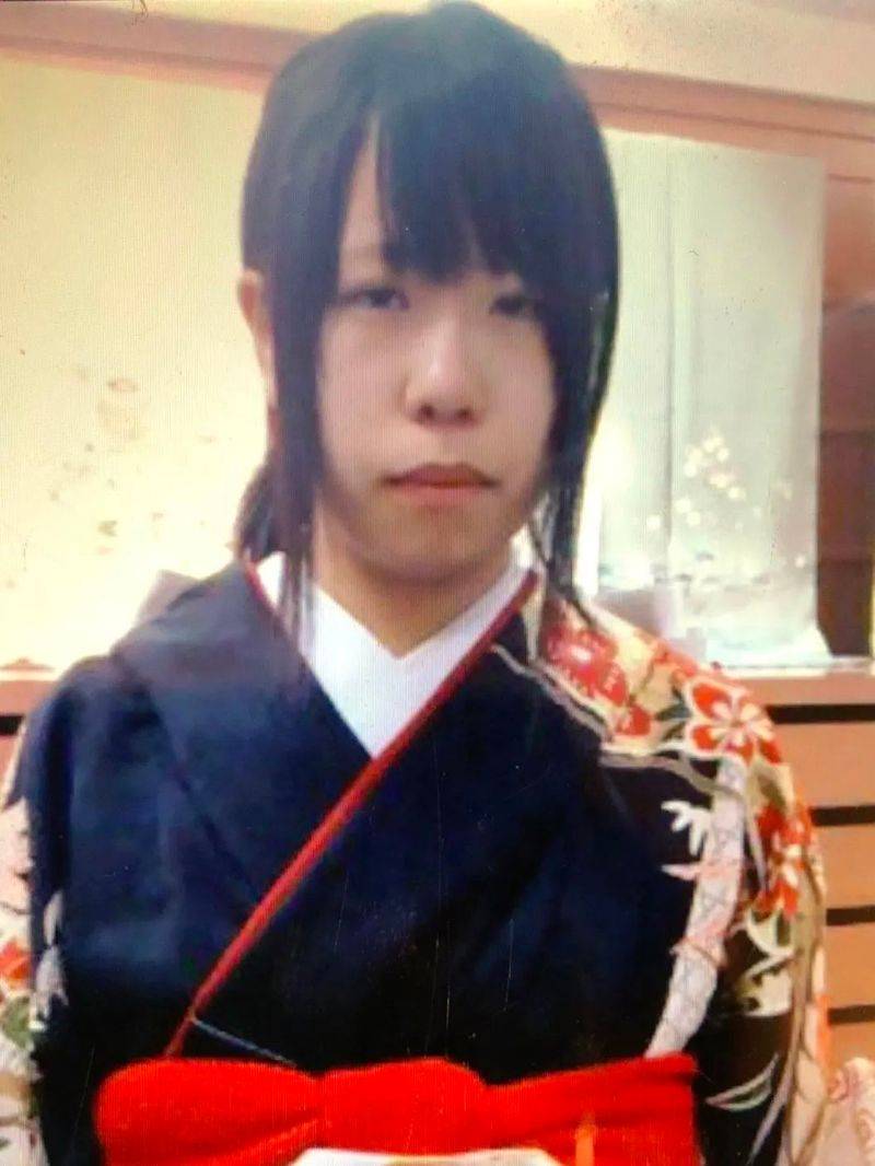 日本割双眼皮多少钱