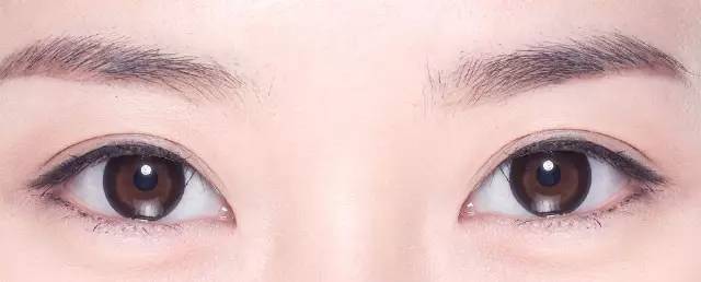 How much is japan's eyelid cut
