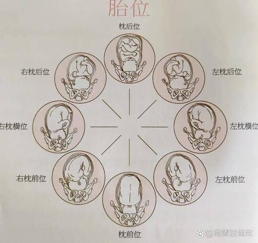 Information on childbirth for pregnant women