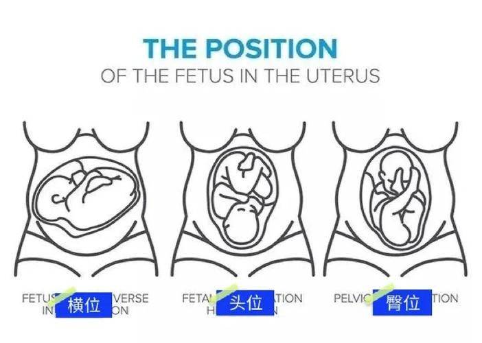 Information on childbirth for pregnant women