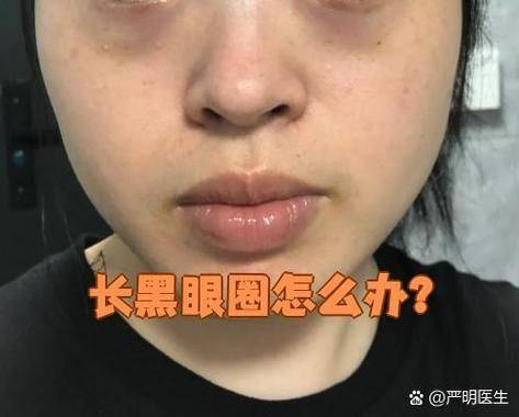 科颜氏牛油果眼霜步骤