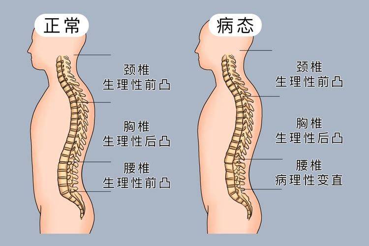 A map of the way you exercise your waist muscles