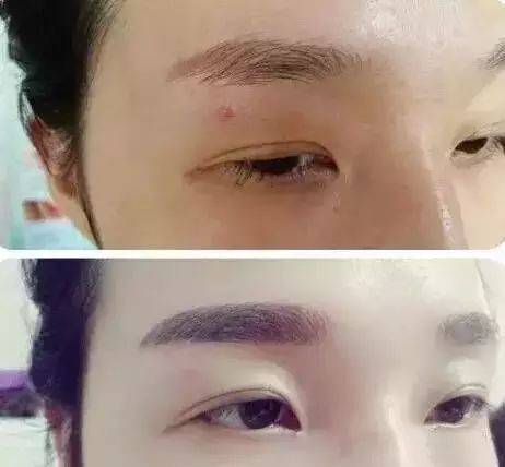 抚顺姚大夫纹美瞳线多少钱