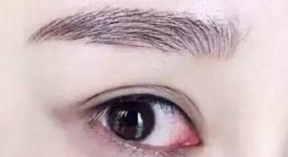 抚顺姚大夫纹美瞳线多少钱