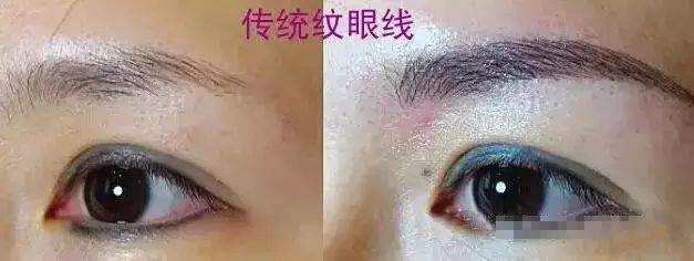 抚顺姚大夫纹美瞳线多少钱