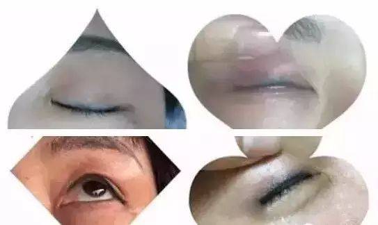 抚顺姚大夫纹美瞳线多少钱