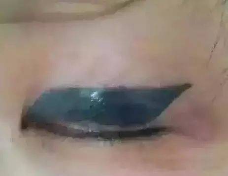 抚顺姚大夫纹美瞳线多少钱