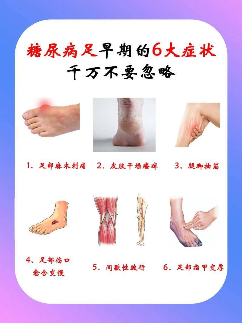 糖尿病用药特点