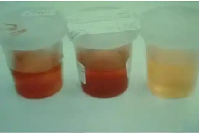 度冷丁镇痛作用的原理