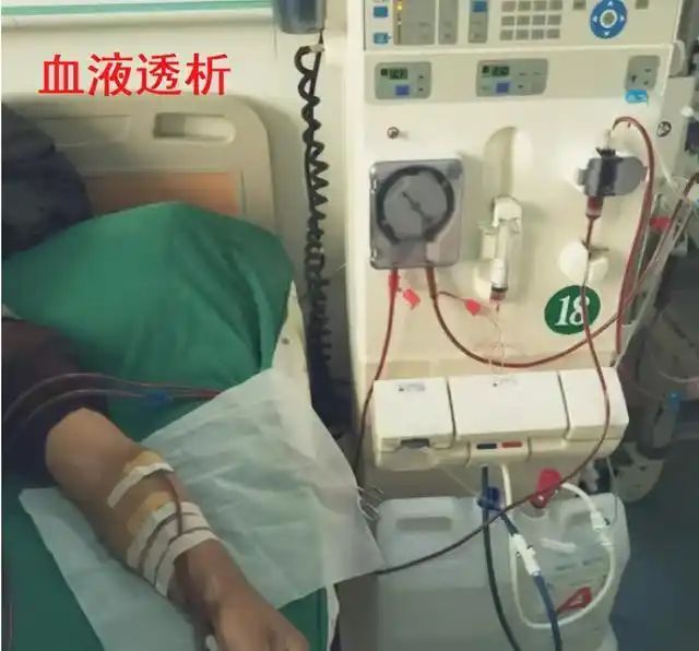 度冷丁镇痛作用的原理