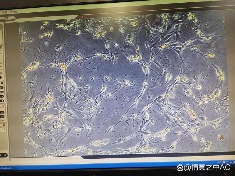 内毒素作用机理
