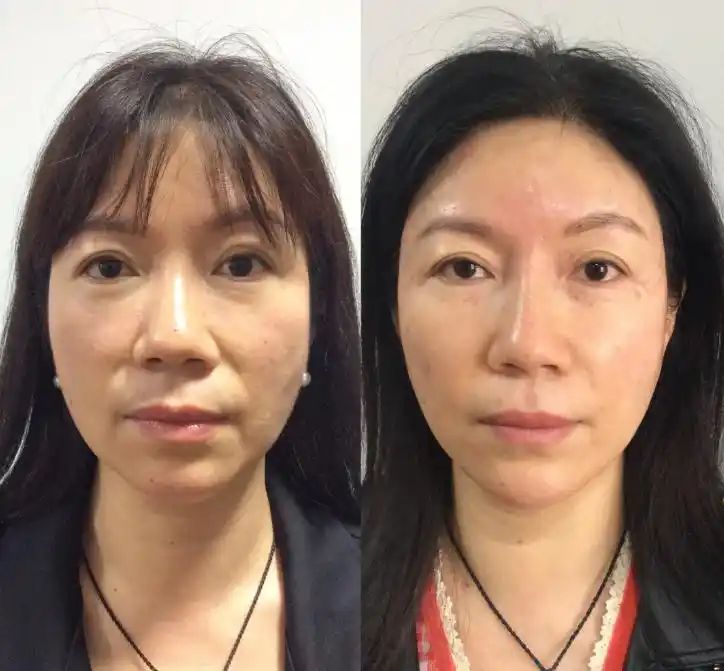 玉兰油7重功效多少钱
