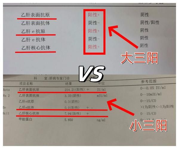上海乙肝两对半检查多少钱