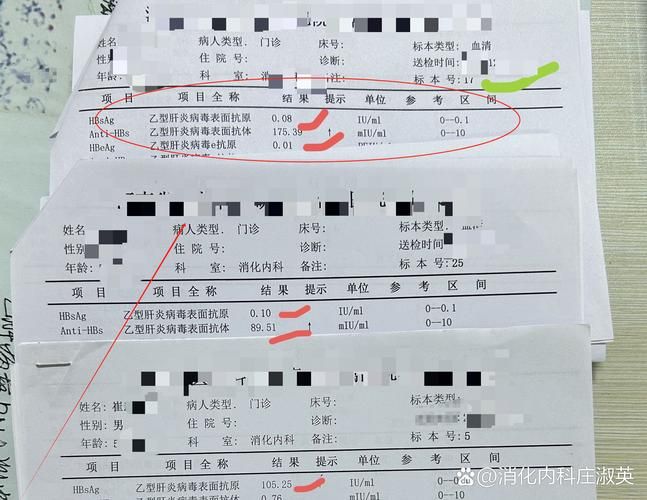 上海乙肝两对半检查多少钱