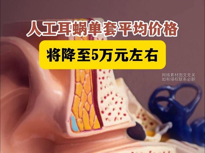 突发性耳聋费用
