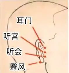 突发性耳聋费用