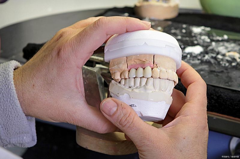 The dental principle