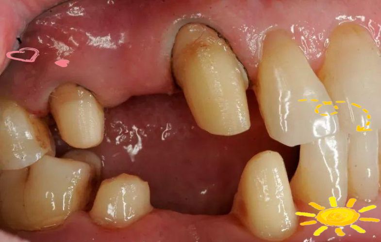 The dental principle