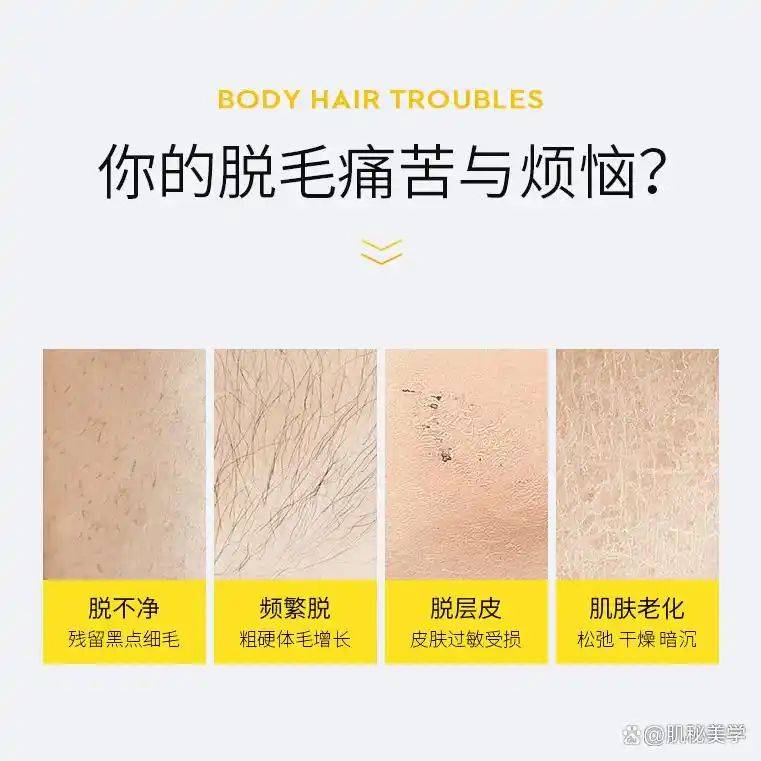 脱毛方法