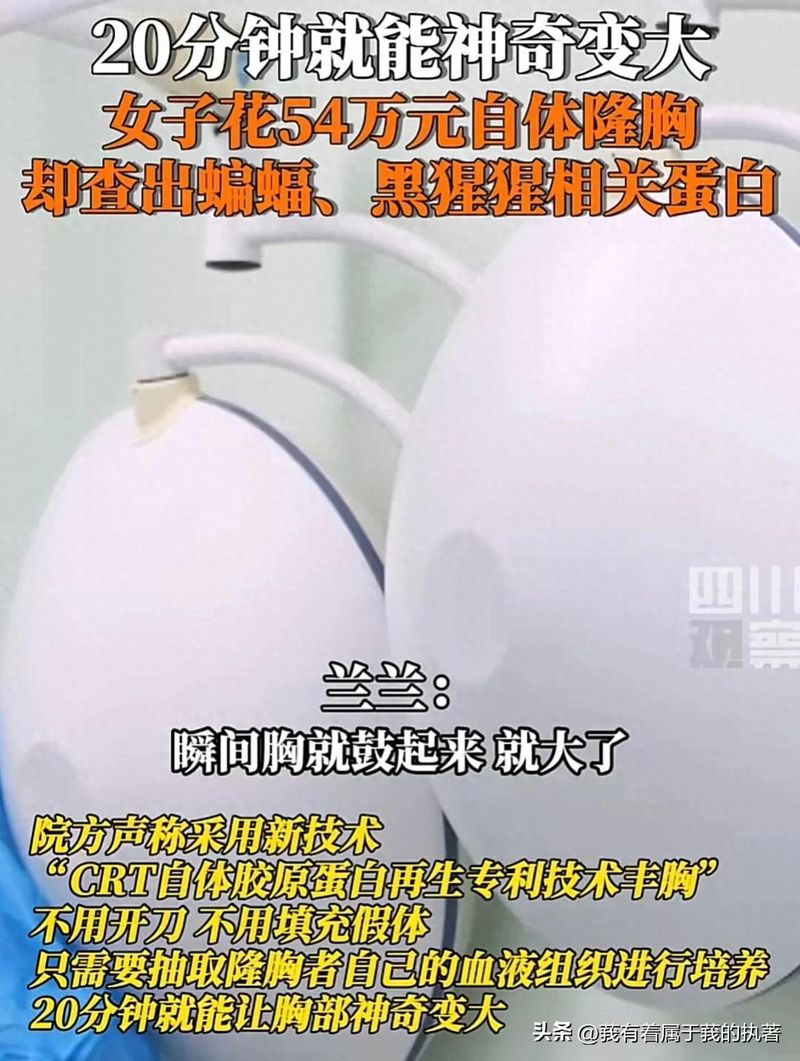 自体丰胸大概多少钱