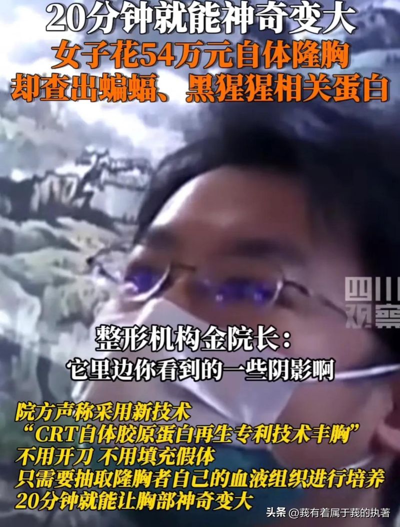 自体丰胸大概多少钱