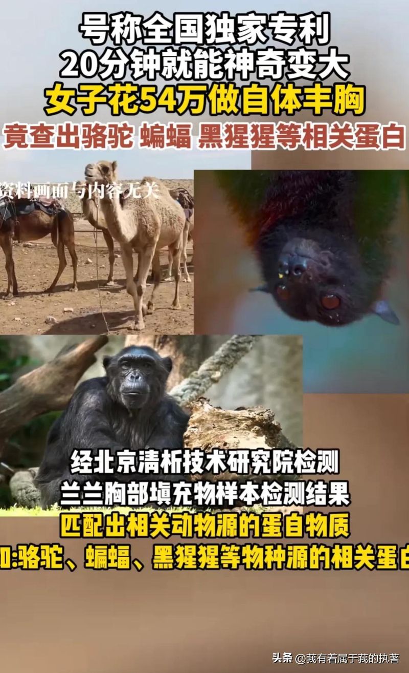 自体丰胸大概多少钱