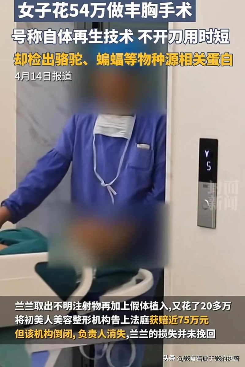 自体丰胸大概多少钱