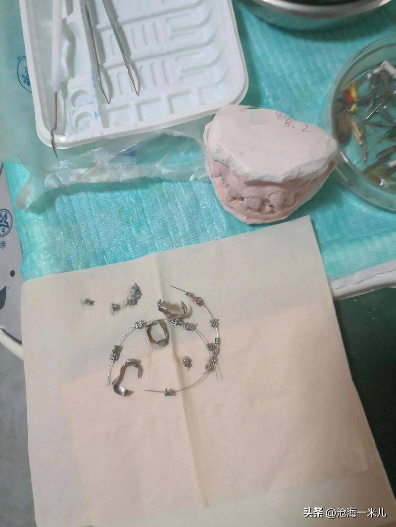 矫正牙齿的保持器多少钱