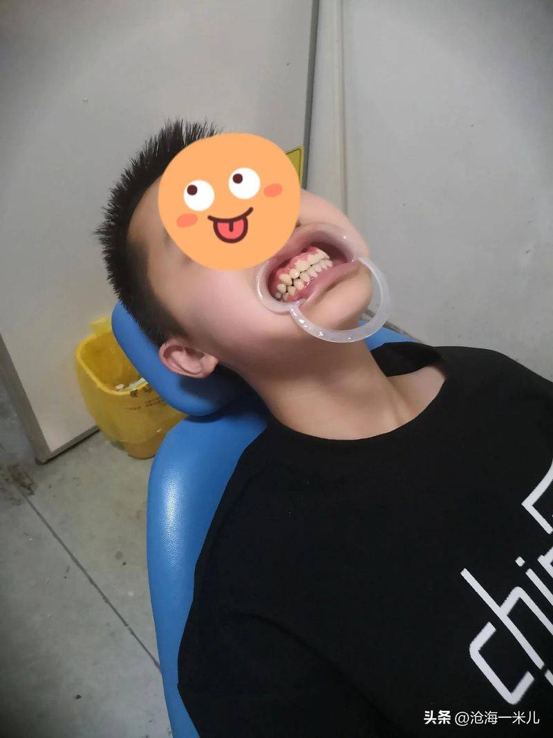 矫正牙齿的保持器多少钱