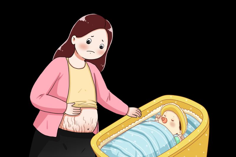 防止妊娠纹的方法
