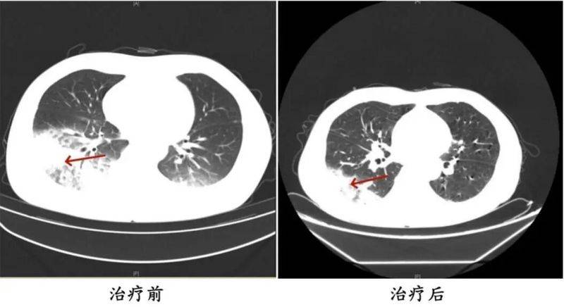 变频空调维修技术论坛